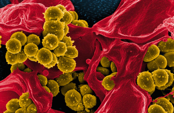 Antibacterial properties of CBD